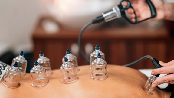 Cupping