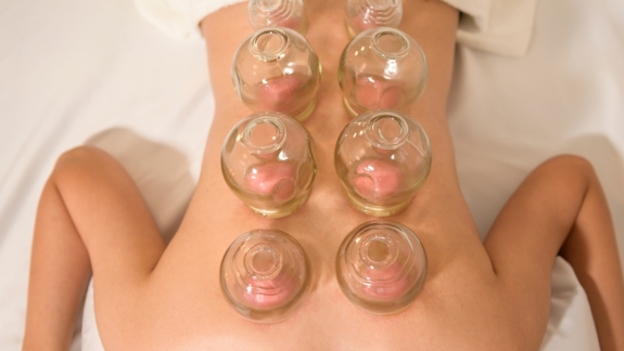 Cupping